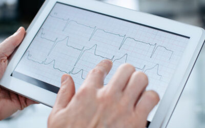 Implante de marcapasso: entenda o procedimento