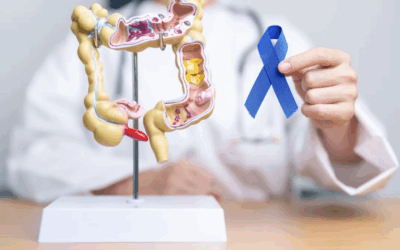 Câncer colorretal: diagnóstico precoce é essencial para salvar vidas